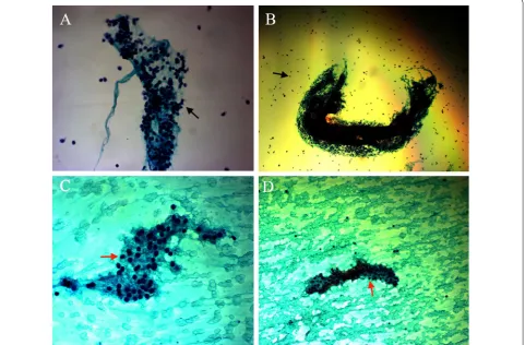 Fig. 1 Pathological features of the two groups: A HT group (under light microscope, ×20); B HT group (under light microscope ×5); C, D GD group (under light microscope ×20)
