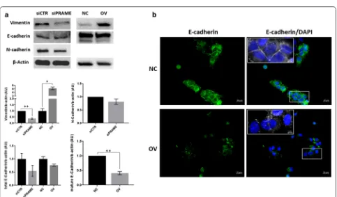 Fig. 4 PRAME overexpression mediates invasion through 3D Matrigel. a Inverted Matrigel invasion of TNBC cells stably transduced with control vector or full‑length PRAME