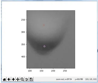 Figure 7 : Gray image of fig 4 