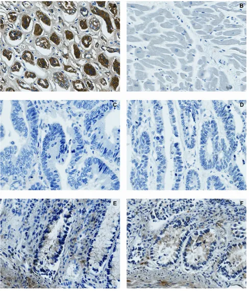 Figure 6Lack of MAL protein expression in colorectal carcinomaskidney tubuli (A), and no staining was observed in heart mus-cle (B), in agreement with earlier reports [30]
