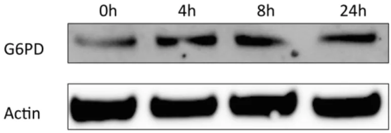 Figure 2.3 G6PD protein increases by E. coli LPS stimulation. HGEPs were treated with E.coli  LPS (1ug/ml) for 0, 4, 8 and 24h and blotting for G6PD showed protein up-regulation