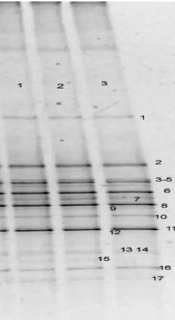 Figure 3.1. DGGE Profile of Bacterial Amplicons from CMN. Lanes 1-3 represent replicate DNA extraction protocols.