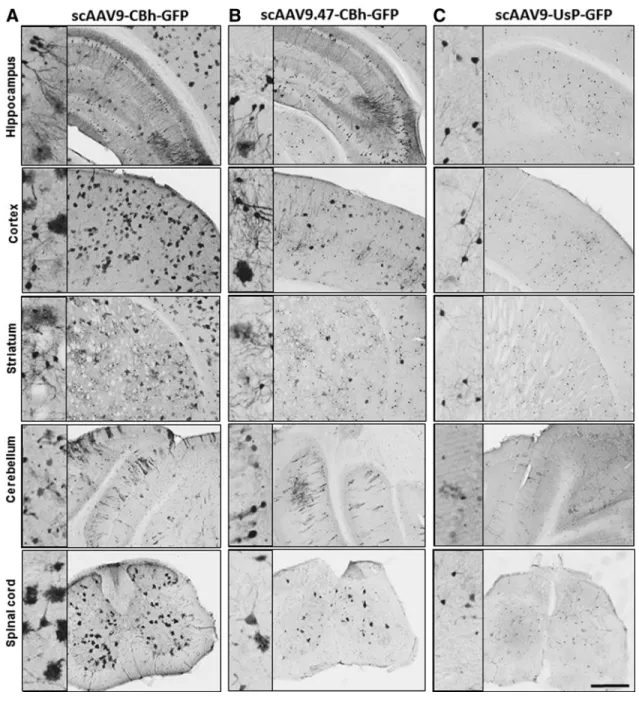 Figure 2. CNS transduction pattern of AAV9/CBh-GFP, AAV9.47/CBh-GFP, and AAV9/UsP-GFP after intravenous administration in wild-type mice