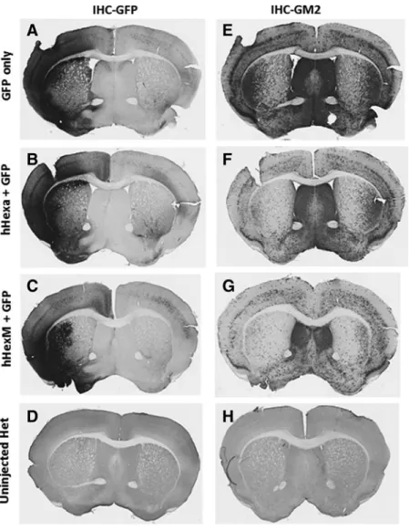 Figure 5. HexM is capable of reducing long-standing G M2 in aged Tay-Sachs mice. Fifteen-month-old TS knockout mice received a single unilateral intracranial injection of a two-vector mixture containing equal amounts of scAAV9/UsP-GFP and scAAV/UsP-HEXA or