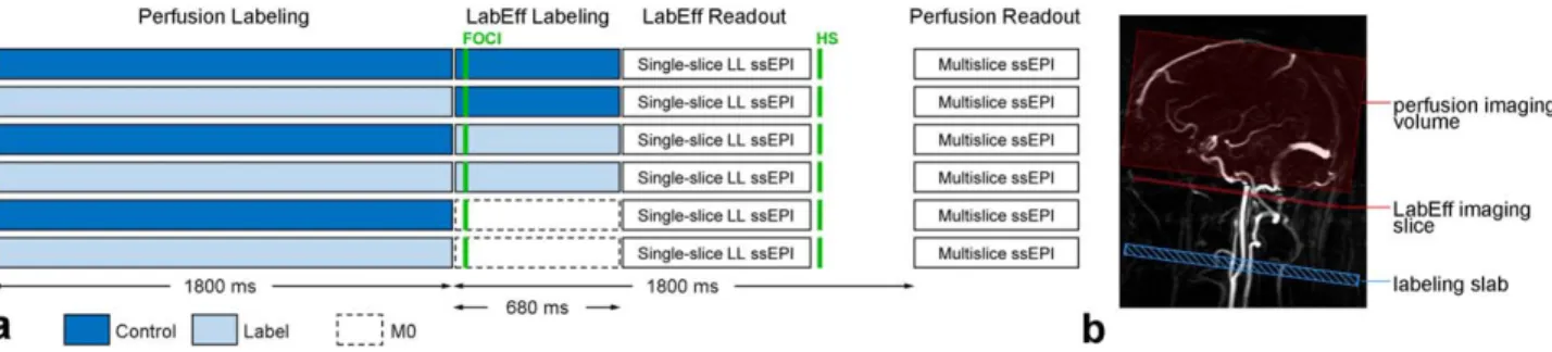 FIG. 1. Diagram (a) of the combined perfusion and labeling efficiency (LabEff) sequence and its planning (b)