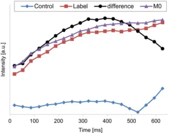 FIG. 7. Representative vertebral artery signals acquired by the combined labeling efficiency measurement, showing influence of the first background suppression inversion pulse