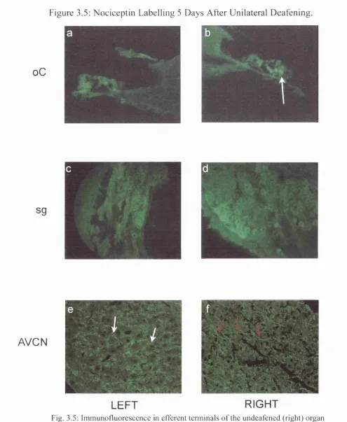 Fig. 3.5: Immunofluorescence in efTerent terminals of the undeafened (right) organ of Corti (a, oC) appeared brighter than in the deafened side (b)