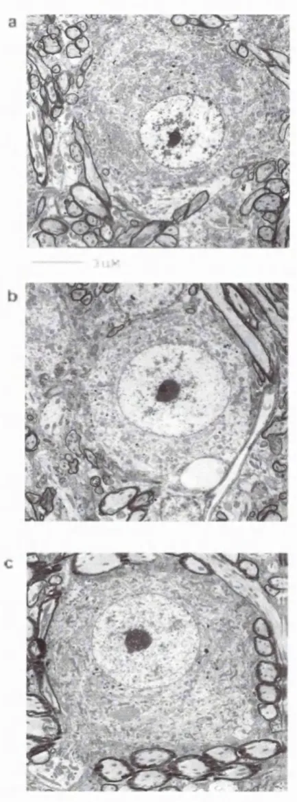Figure 2.2: Increase in Guinea Pig Spherical Cell Size