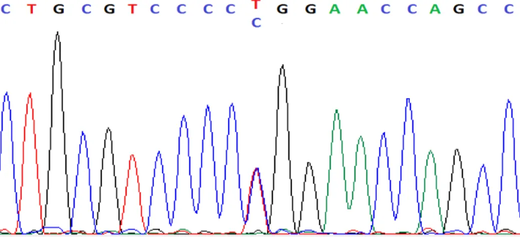 Figure 8: Chromatogram of PTH1R c.1116+58T>C variation present in intron region in patient with Type  1 SRA