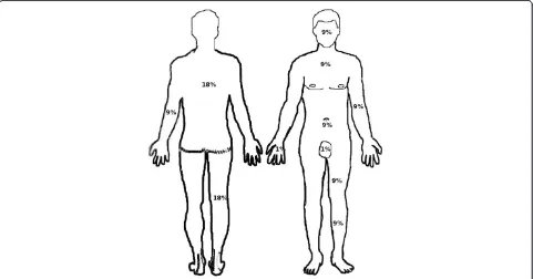Figure 1 Rule of nines: This figure shows the different parts of the body that equal 9% of the body surface area (i.e