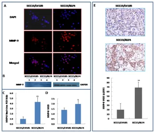 Figure 6: Stable transduction of KLF4 into SCC15 cells could increase cell migration and invasion ability
