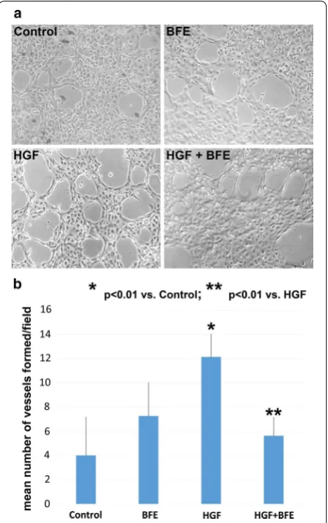 Fig. 4 BFE was able to suppress the pro-angiogenic effect of HGF on human endothelial cells: a images taken demonstrating the degree of tubulogenesis/vessel formation by the HECV human endothelial cell line