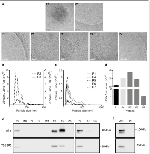 Fig. 2 uEVs characterization. a Representative cryo‑TEM images of all the uEVs pellets obtained from different isolation procedures