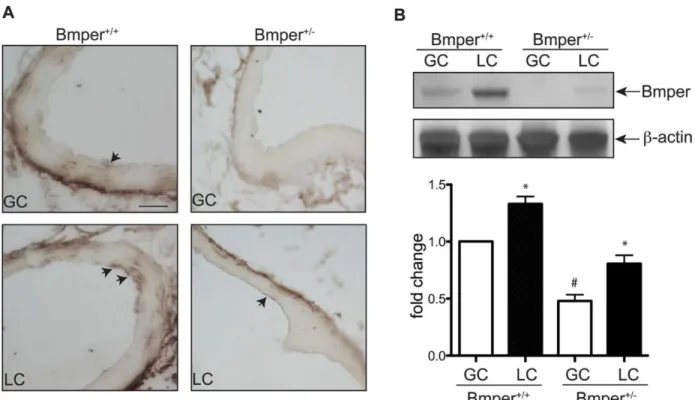 Figure 2-10. BMPER protein level was increased in the LC compared to GC. 