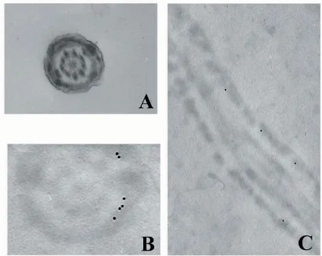 Figure 2lated spermatozoa collected from fertile donorsTransmission electron microphotographs of human ejacu-Transmission electron microphotographs of human ejaculated spermatozoa collected from fertile donors