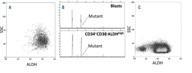 Figure 3. Prominent ALDH high populations of CD34 + CD38 – cells. (A) Representative flow cytometric staining pattern of ALDH activity by side scatter (SSC) is displayed for CD34 + CD38 – cells isolated from patient