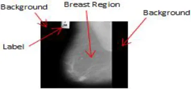 Fig 1. Detail Mammogram Image  