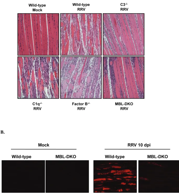 Figure 2.2: MBL is required for development of severe RRV-induced pathology and  tissue damage within skeletal muscle