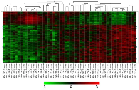 Figure 4set)Differentially expressed genes in the two subgroups of glioblastomas with strong and weak TGFβ response (in the Freije data-Differentially expressed genes in the two subgroups of glioblastomas with strong and weak TGFβ response (in 