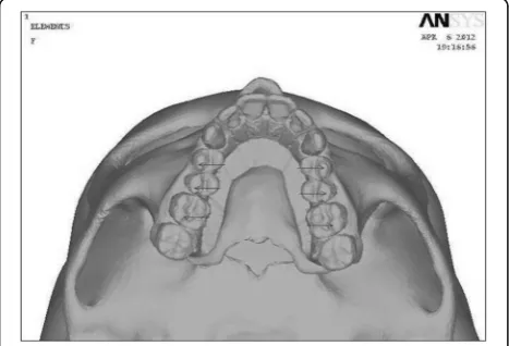 Fig. 5 Palatal view of the three-dimensional FE model