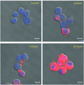 Figure 4 In vitro DCT release profiles from PS-PDLLA NPs. Note: each point indicates the mean ± sD (n=4).Abbreviations: DcT, docetaxel; NP, nanoparticle; Ps-PDlla, poly(styrene)-b-poly(Dl-lactide); sD, standard deviation.