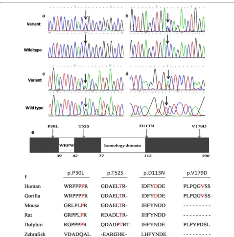 Fig. 1 RIPPLY3 variants in CTD patients. a–d Chromatograms of the RIPPLY3 variants found in CTD patients