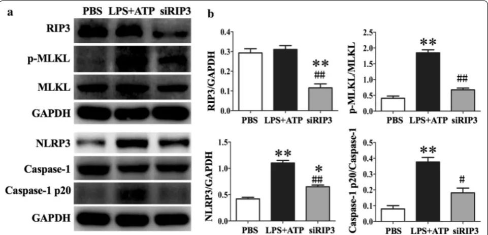 Fig. 7 RIP3 silencing inhibited LPS-induced NLRP3 inflammasome activation in THP-1 cells