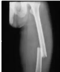 Fig. 8. Deblurred Image using         Fig. 9. Salt and Pepper Image           Fig. 10