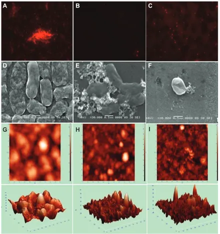 Figure 8A–I Images of Acinetobacter baumannii biofilm formation and inhibition using fluorescence microscopy, scanning electron microscopy (SEM), and atomic force microscopy (AFM)