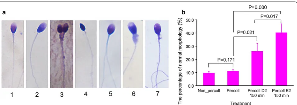 Fig. 3 The percentage of sperm concentration at different positions. fixed 200 μl of sperm suspension was put in Chamber A, the original are able to swim to positions D2 and E2 from Chamber A in 150 min and the majority of sperm were screened