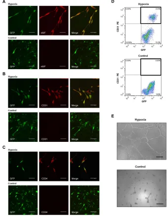 Figure 2: Transdifferentiation of C6 glioma cells into ECs in vitro. A-C. Representative images of C6 glioma cells in hypoxia group (cultured in endothelial differentiation medium in hypoxia; top) and control group (cultured in DMEM/F12 in normoxia; bottom