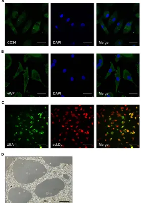 Figure 4: Identifying the characteristics of spleen-derived endothelial progenitor cells (EPCs)