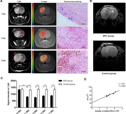 Figure 5: Magnetic resonance imaging (MRI) tracking and quantifying of EPCs incorporation into tumor in vivo