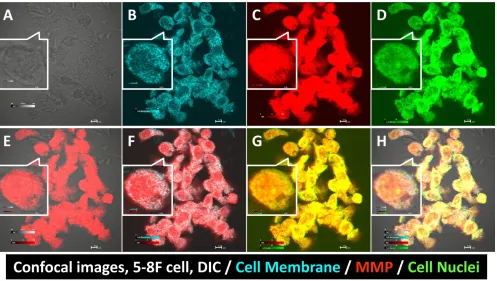Fig 2: CXCR4 confocal imaging of human NPC CNE-2 cells. The CXCR4 agent bound to CNE-2 cells (A)
