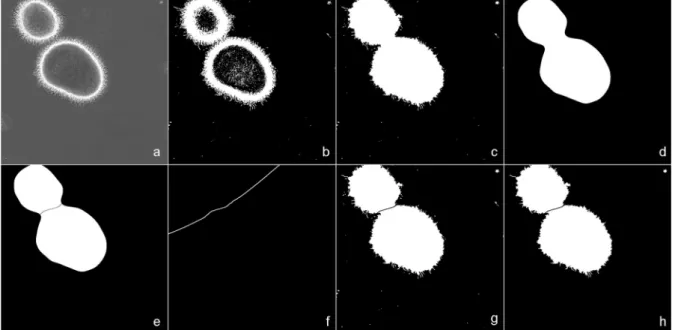 Fig. 1 Steps of ROI identification. The original image (a) is transformed into black &amp; white (B&amp;W; b) using thresholding.
