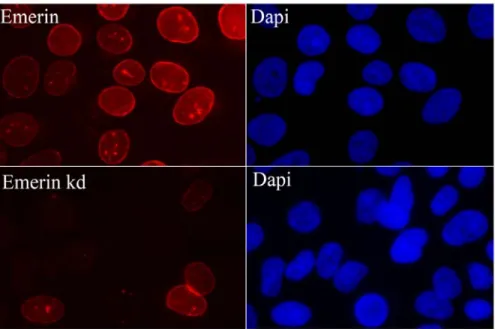 Figure 4. A reduction of emerin by shRNA interference in U2OS cells is shown in the lower  panel, using an antibody directed against endogenous emerin
