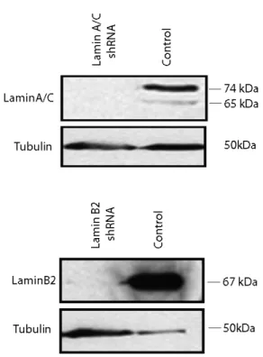 Figure 1A  U2OS cells were transiently transfected with short hairpin (sh) RNA constructs  from a viral based vector system directed against lamin A and lamin B