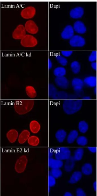 Figure 1B. Immunocytochemical images of U2OS cells transiently transfected with short  hairpin (sh) RNA constructs from a viral based vector system directed against lamin A and  lamin B