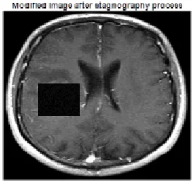 Fig. 4.  (a) detected tumor object (b) Image used for embedding 