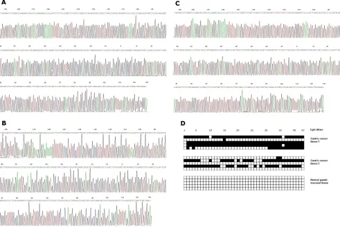 Fig. 4: (A) Bisulphite sequencing figure of gastric cancer tissue 1, (B) Bisulphite sequencing figure of gastric cancer tissue 2, (C) Bisulphite sequencing figure of normal gastric mucosal tissue, and (D) Bisulfite sequencing results in gastric cancer tissues and in normal gastric mucosal tissue.