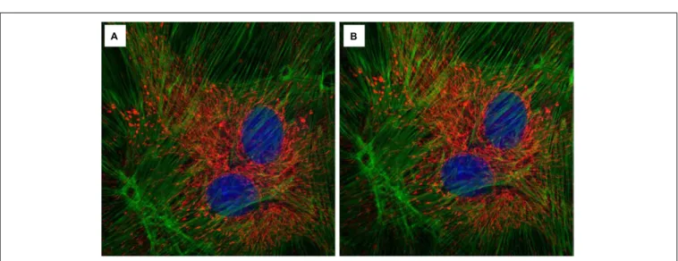 FIGURE 9 | Effect of the InverterScope on light intensity compared to standard inverted confocal imaging configuration