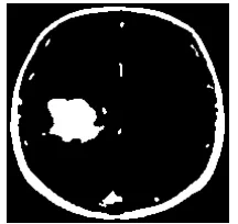 Fig. 7 Image after KIFCM Process 