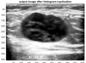 Figure 3: Image after speckle reduction 