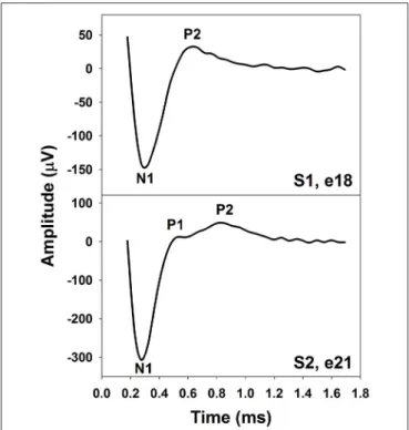 FIGURE 1 | The eCAP with one (Upper) or two positive peaks (Lower).