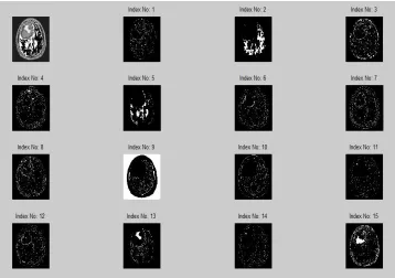 Fig -8: The Neural Network architecture 