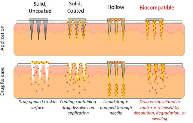 Figure 1.3 Microneedle configurations. The method of application and drug release for each of four different  microneedle configurations