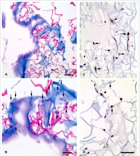 Figure 2 Photomicrographs of histological sections from integrated implant system (IIS) stained with a trichromic stain (A-B) and immu-nohistochemical staining for Proliferating Cell Nuclear Antigen (PCNA) (C-D)
