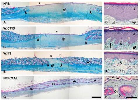 Figure 4 Photomicrographs of histological sections from skin stained with a trichromic stainfree of hairs and only a small region of granulation tissue below (gt), flanked by profuse bundles of hair.follicles (arrowheads)