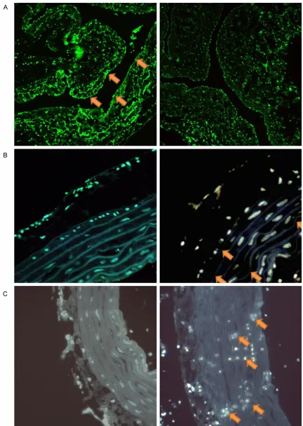 Figure 6. Immunofluorescence staining shows that the expression of Cx43 (A), Zo-1 (B) is lower and discontinuous in the treatment group than the control group in heart coronary artery, CD14 positive monocyte (C) is shown prone to infiltrate aorta wall in experimental group.