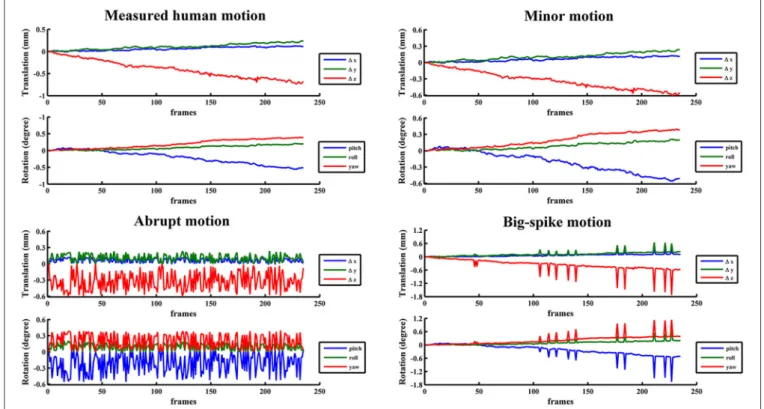 FIGURE 2 | The estimated motion from a representative subject and three corresponding typical types of motion were illustrated with head motion curves.